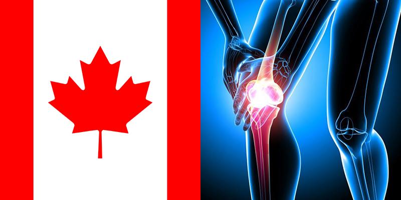 Osteoarthritis in Canada