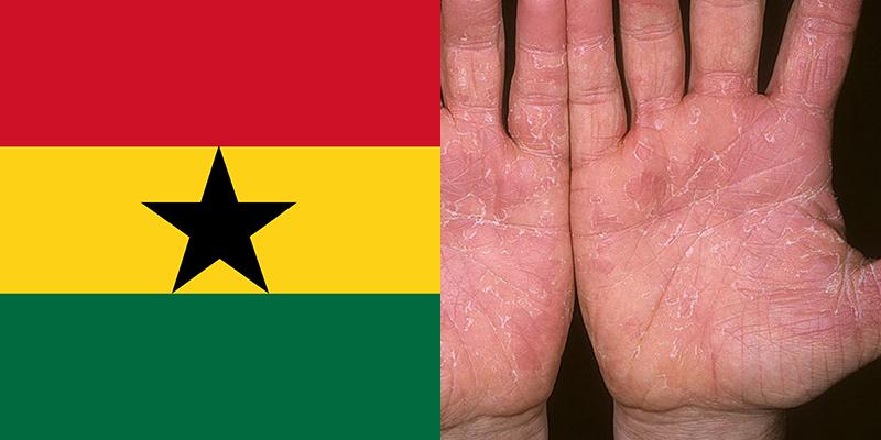 skin-disease-in-ghana