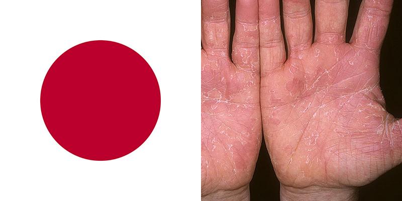 Major Diseases In Japan