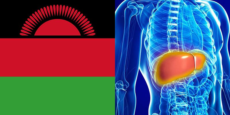 liver-disease-in-malawi