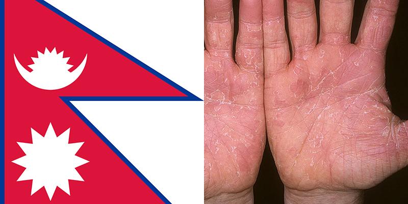 Skin Disease In Nepal